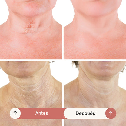 💖 REAFIRMA, HIDRATA Y REJUVENECE TU CUELLO CON FIRMAGE NECK™ ✨
