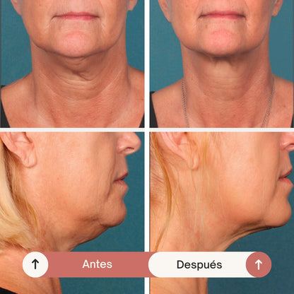 💖 REAFIRMA, HIDRATA Y REJUVENECE TU CUELLO CON FIRMAGE NECK™ ✨