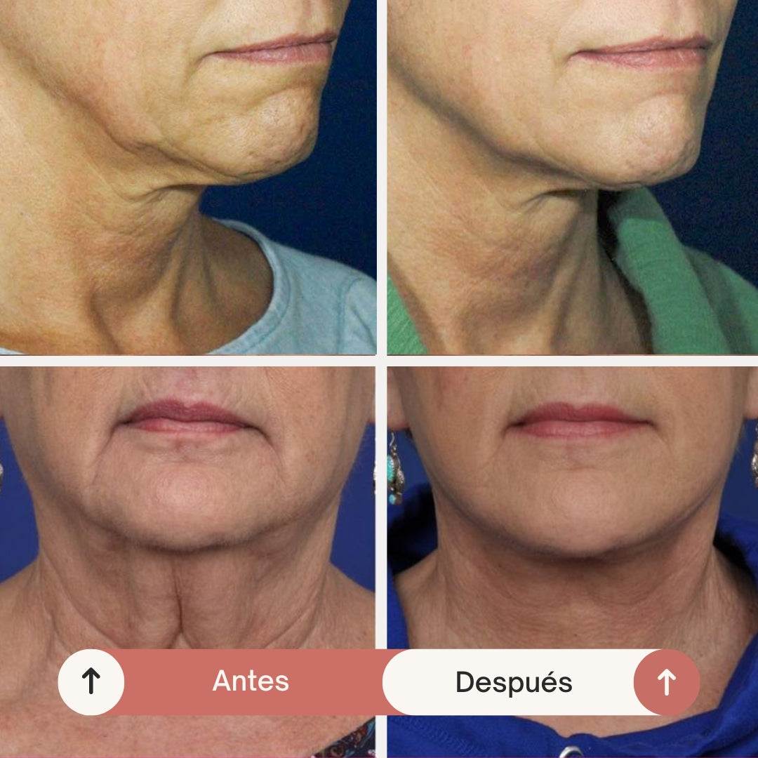 💖 REAFIRMA, HIDRATA Y REJUVENECE TU CUELLO CON FIRMAGE NECK™ ✨