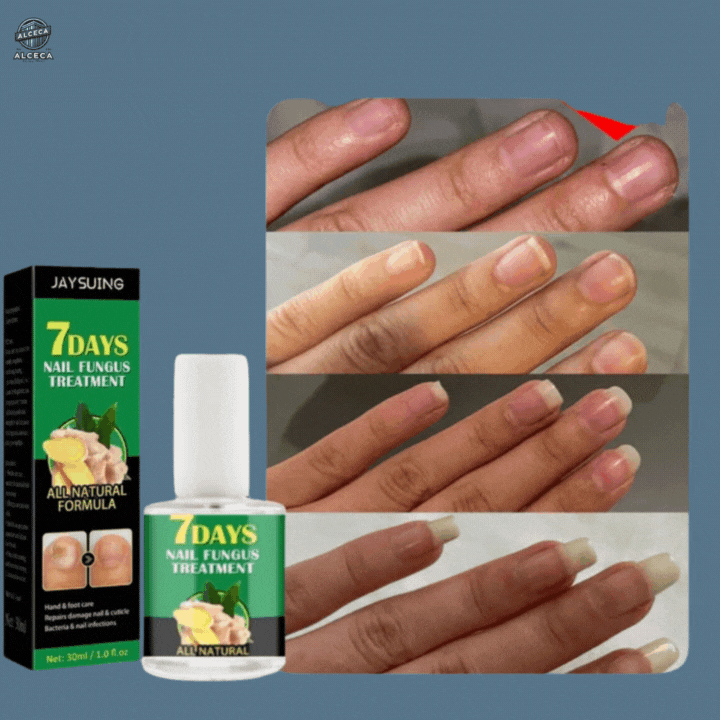 ¡Transforma tus uñas en solo 7 días!