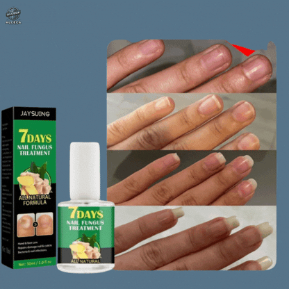 ¡Transforma tus uñas en solo 7 días!