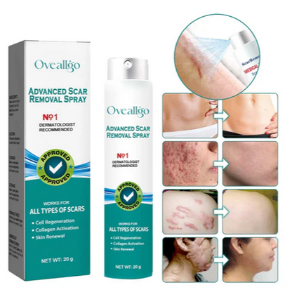 🌟 RenewSkin+™ – Dile Adiós a Cicatrices y Estrías Para Siempre