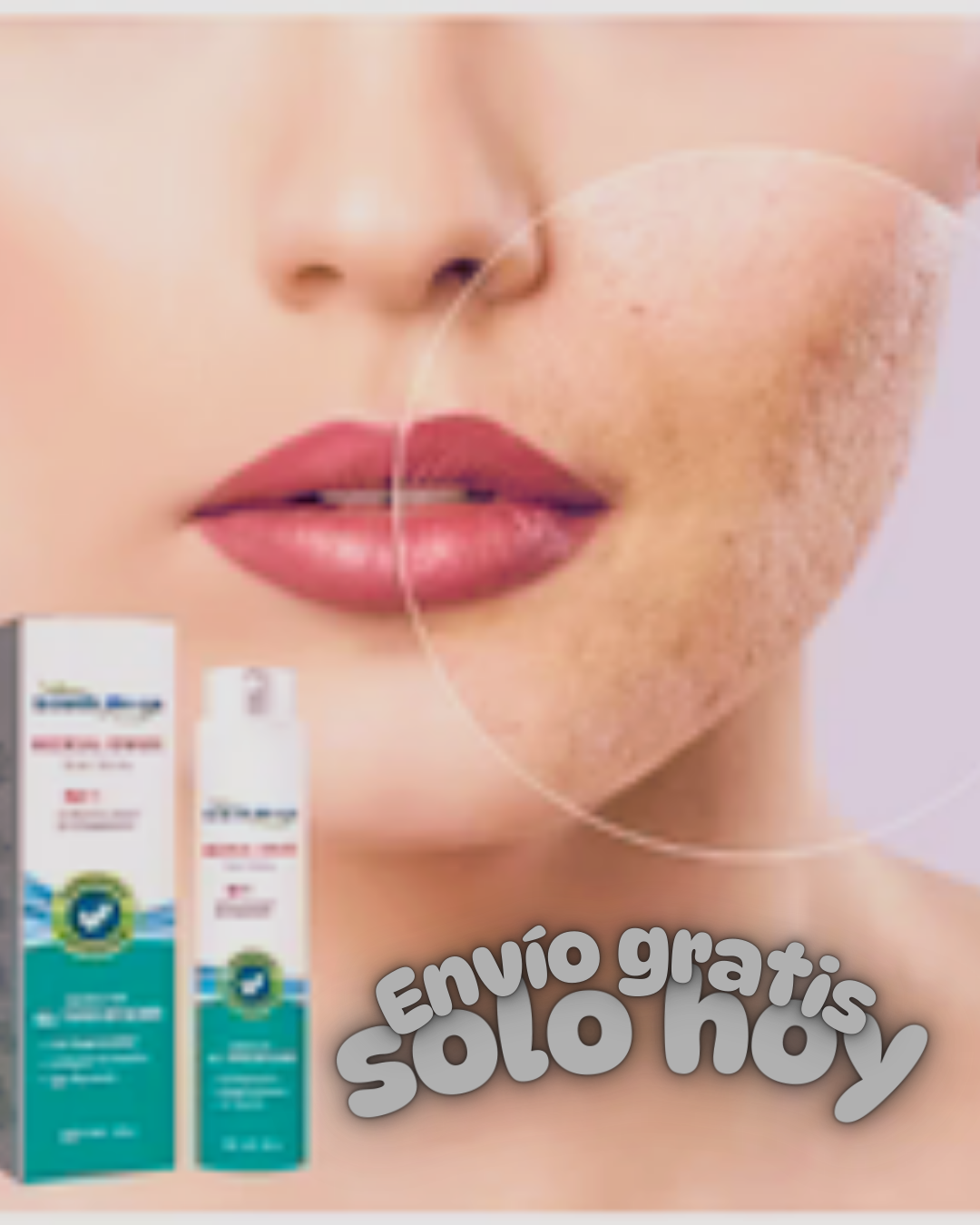 🌟 RenewSkin+™ – Dile Adiós a Cicatrices y Estrías Para Siempre