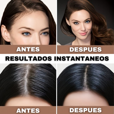 ✨ "Despídete de las Entradas y las Canas al Instante – Cabello Más Lleno en Segundos"